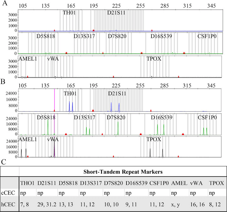 Fig 1. Comparative analysis of short tandem repeat analysis (STR) between human primary choroidal endothelial cells (hCEC) and commercial human choroidal endothelial cells (cCEC). (Peavey J, et al. 2020)