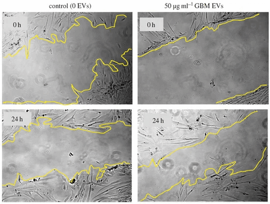 Fig 3. An example of exosomes affecting cell migration. (Hamzah R N, et al. 2021)