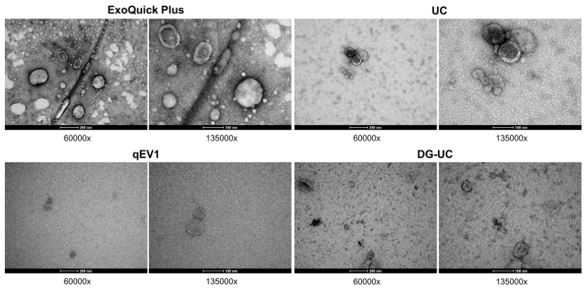 Fig 3. Transmission electron microscopic (TEM) visualization of the EVs isolated from pooled human serum. (Brennan K, et al. 2020)