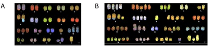 Fig 1. A case of spectral karyotype analysis of a cell line. (Ruf-Zamojski F, et al. 2019)