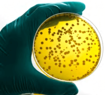 Bacteriostasis and Fungistasis Testing