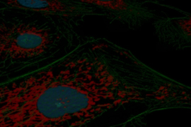 Angiogenesis Assays