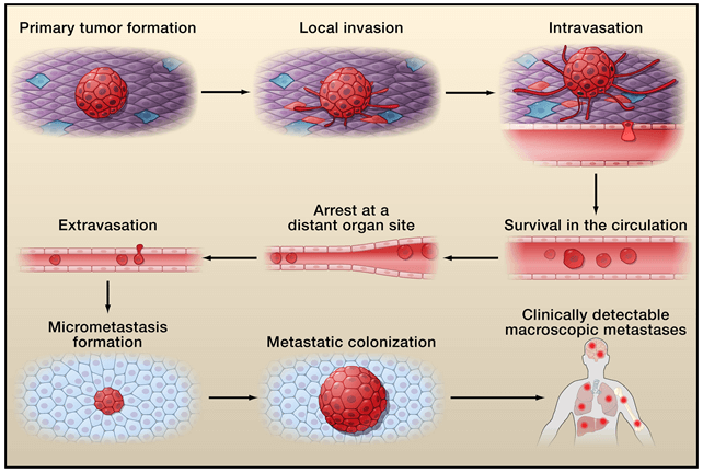  The invasion–metastasis cascade.