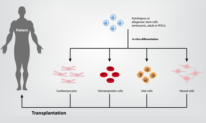 Stem Cell Therapy